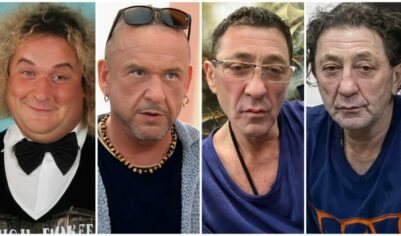 Не только Киркоров и Леонтьев. Пластика знаменитых российских мужчин