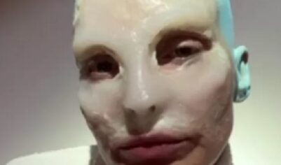 Почему Глюкоза постоянно меняет внешность, объяснил нарколог