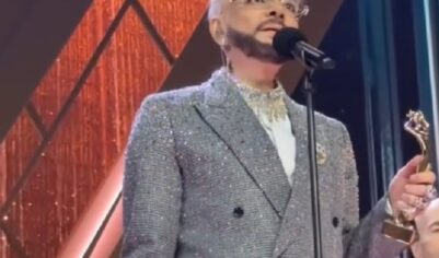 Филипп Киркоров из-за нелюбви к своему телу решился на пластику